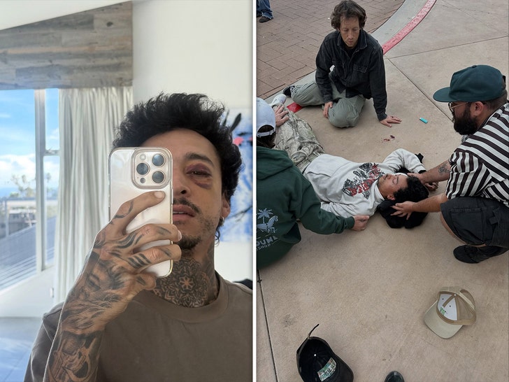 Nyjah Huston in a hospital bed with a visibly bruised, swollen eye after a skateboarding accident, from photos he shared on Instagram.