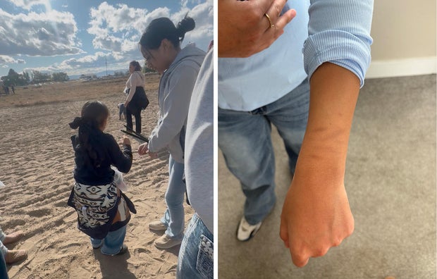 Romero family photo showing zip ties and bruising on a 14-year-old girl's wrists after the Idaho raid